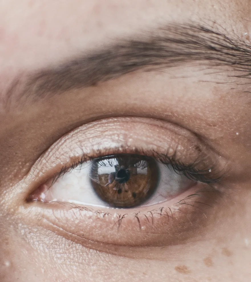 Cernes Contours Des Yeux — illustration de texture de peau