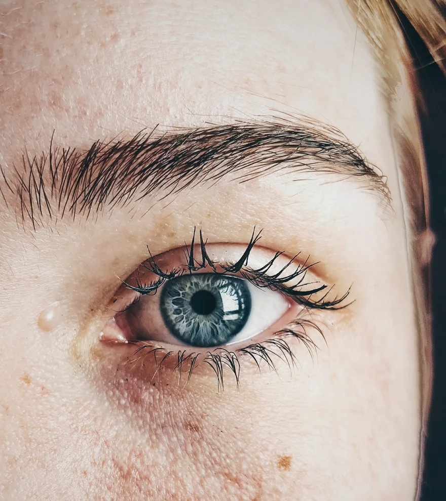 Microneedling — illustration de texture de peau