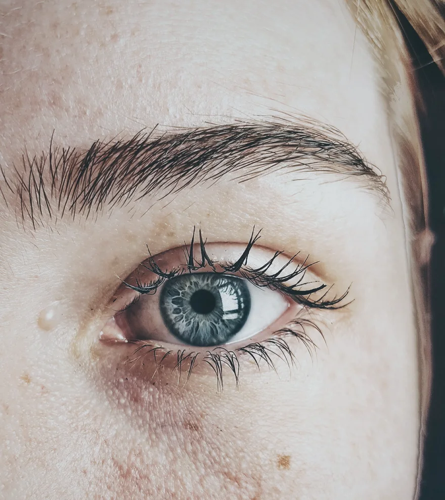 Microneedling — illustration de texture de peau
