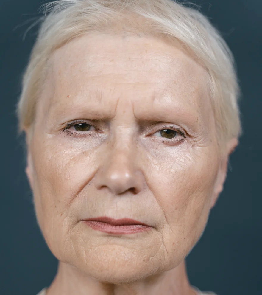 Sculptra — illustration de texture de peau